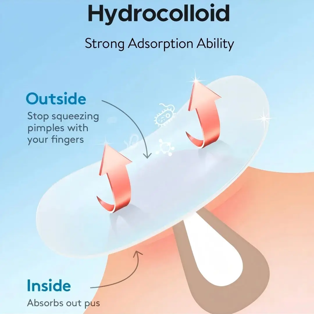 Parche para eliminar el acné de hidrogel (2 formas), 190/380 unids/caja, parche para eliminar el acné de limpieza profunda, parche eficaz para eliminar el acné