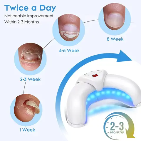 10 best sales फंगस नाखून उपचार - №5