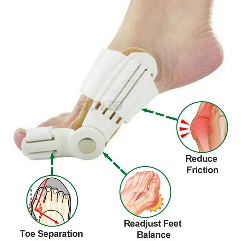 1 قطعة جبيرة ورم العظام الكبيرة تو مستقيم آلام القدم الإغاثة أروح تصحيح لوازم العظام للأقدام الصحية #3