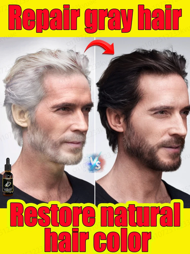 Gray hair repair essential oil, remove gray hair and restore natural hair color in 7 days