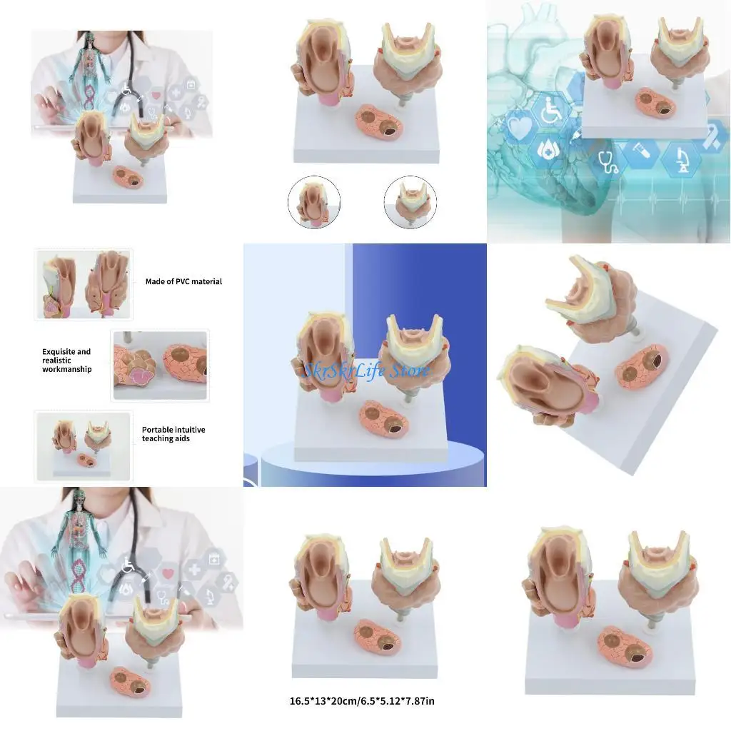 

E65E Pathological Thyroid Gland Anatomy Model for Diseases Study, Human Thyroid Model