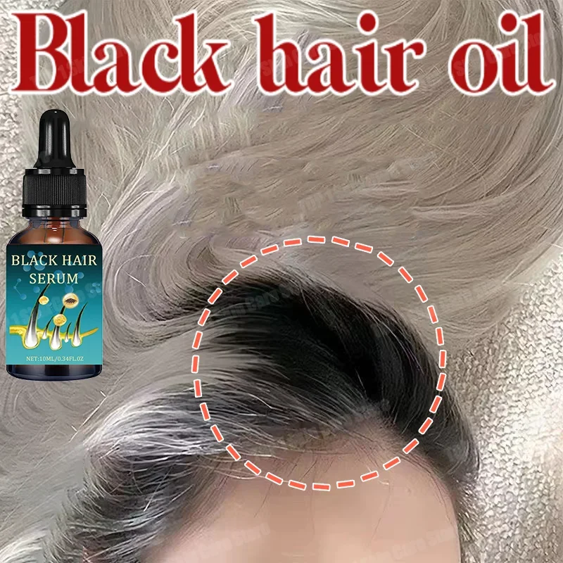 10 days Hair roots grow black essence Hair care Anti-grey ahair essence Serumrestore natural color and restore Black the growth