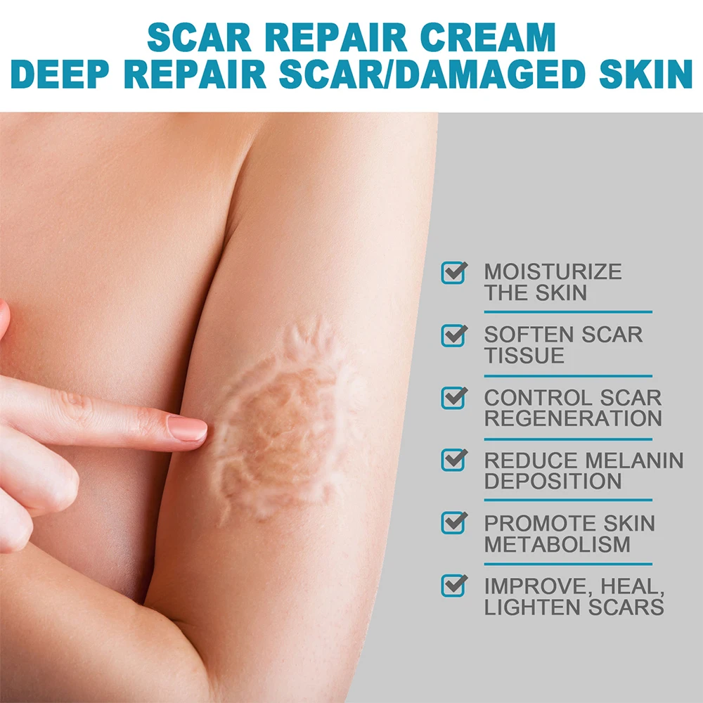 20g Recovery Scar Cream Fast Removal Skin Scars Treat Surgery Scars Stretch Marks Acne Pox Prints Burn Repair Facial Care Gel