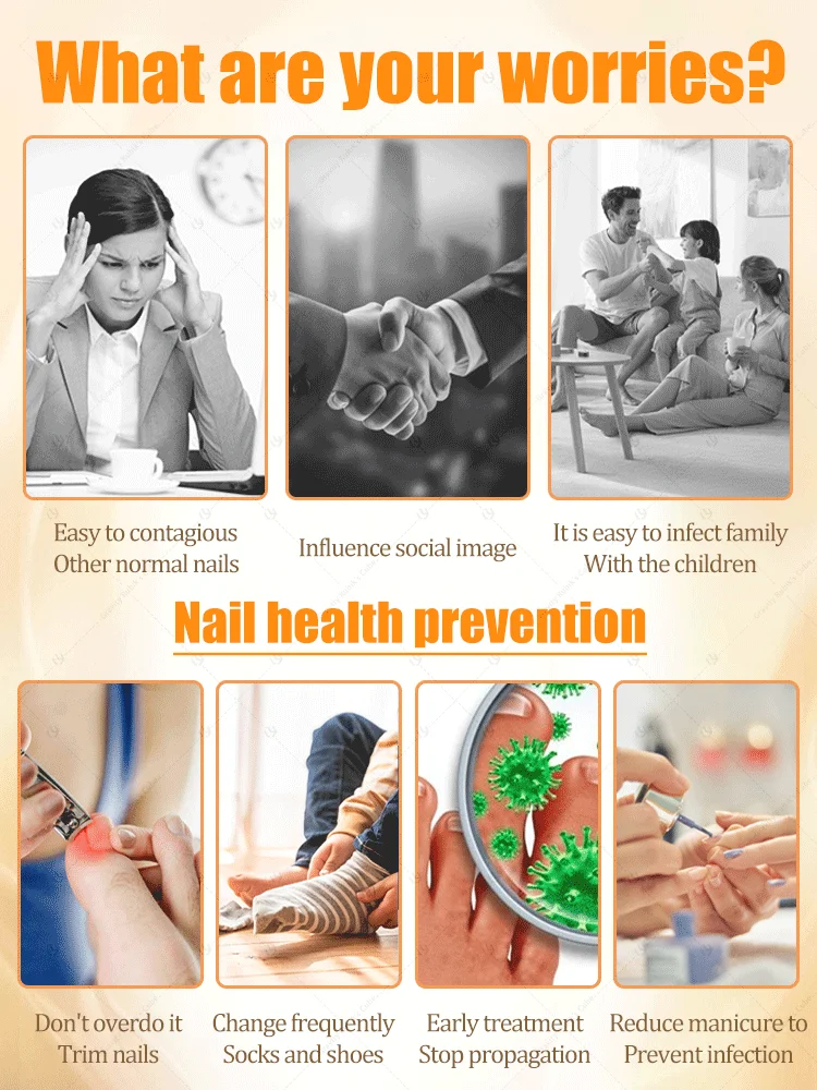 Nenhum danificado às unhas. Ferramentas para aparar nail art, sem recurrença