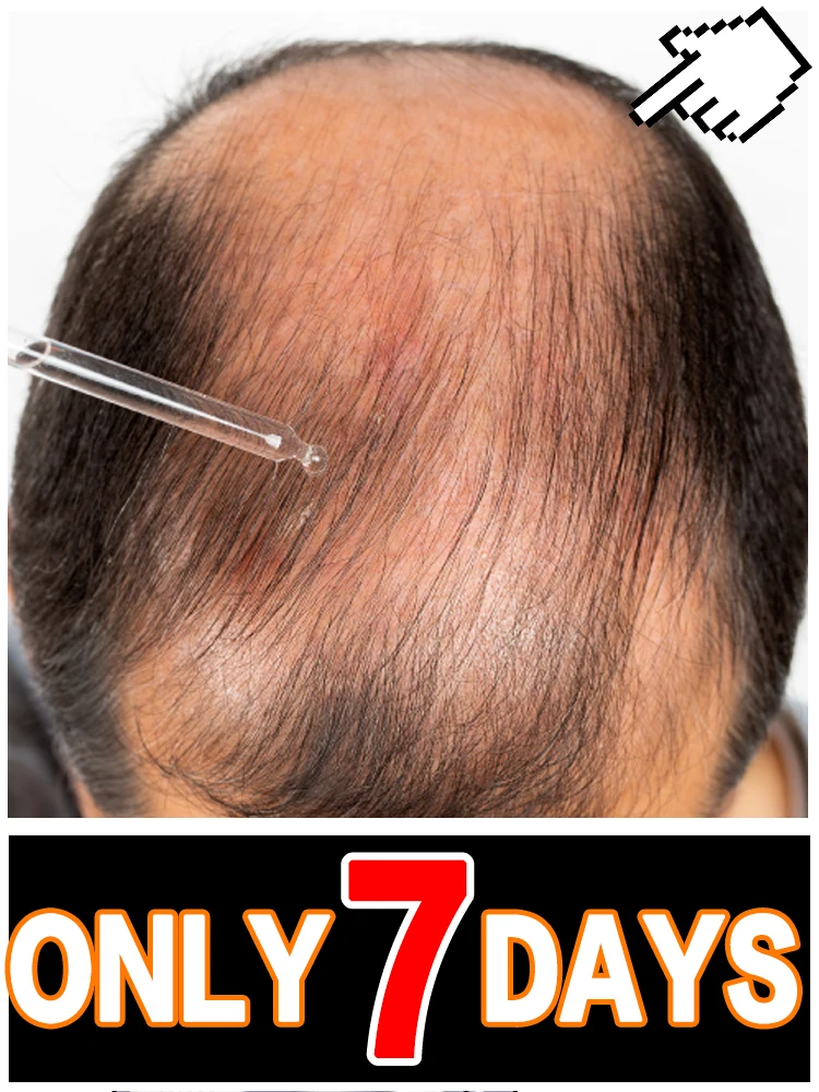 

Модернизированный аппликатор кожи головы 2025 года предназначен для ухода за волосами и кожей головы, нанесения и массажа кожи головы.