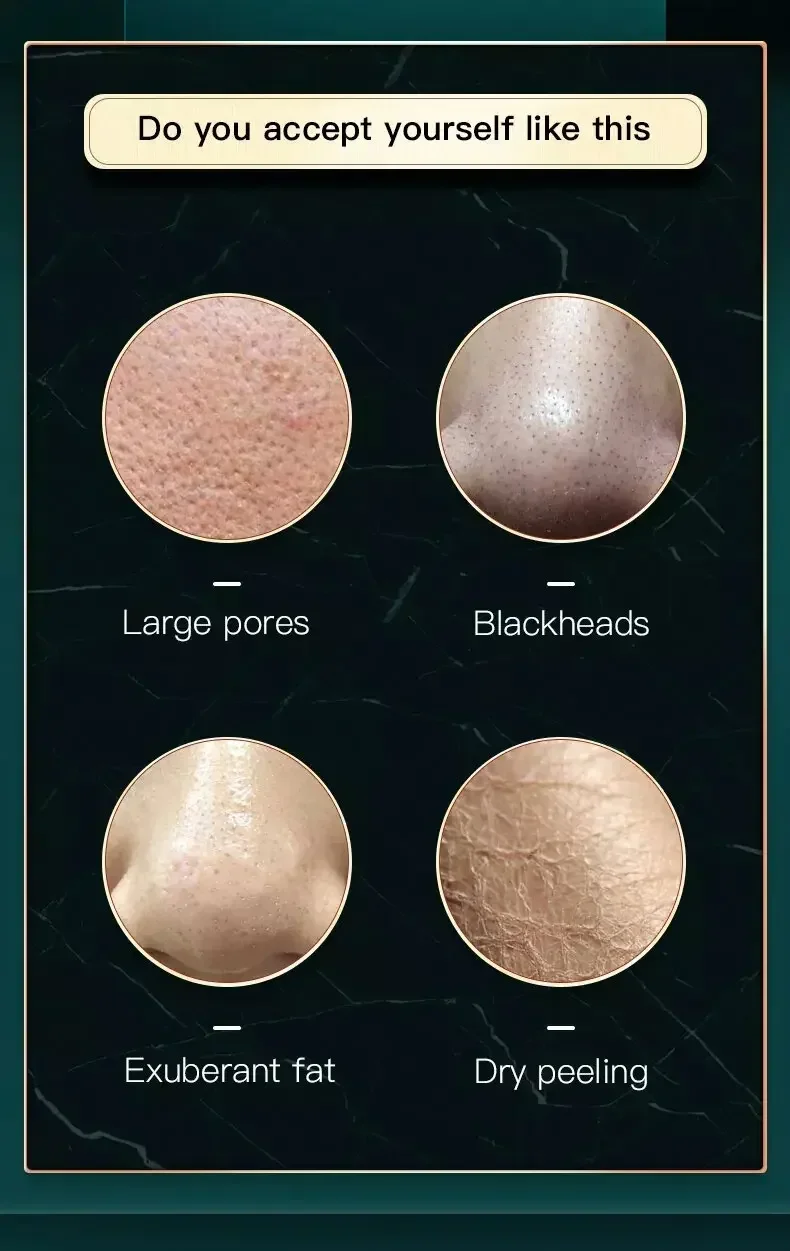 أداة حقن الأكسجين ذات الفقاعات الصغيرة هيدرا جلدي أداة تجميل لتنظيف الرؤوس السوداء