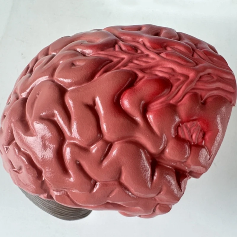 Top-Human Brain Disease Model - Brain Pathology Brainstem Hemorrhage  Teaching Model - Human Brain Anatomy Model