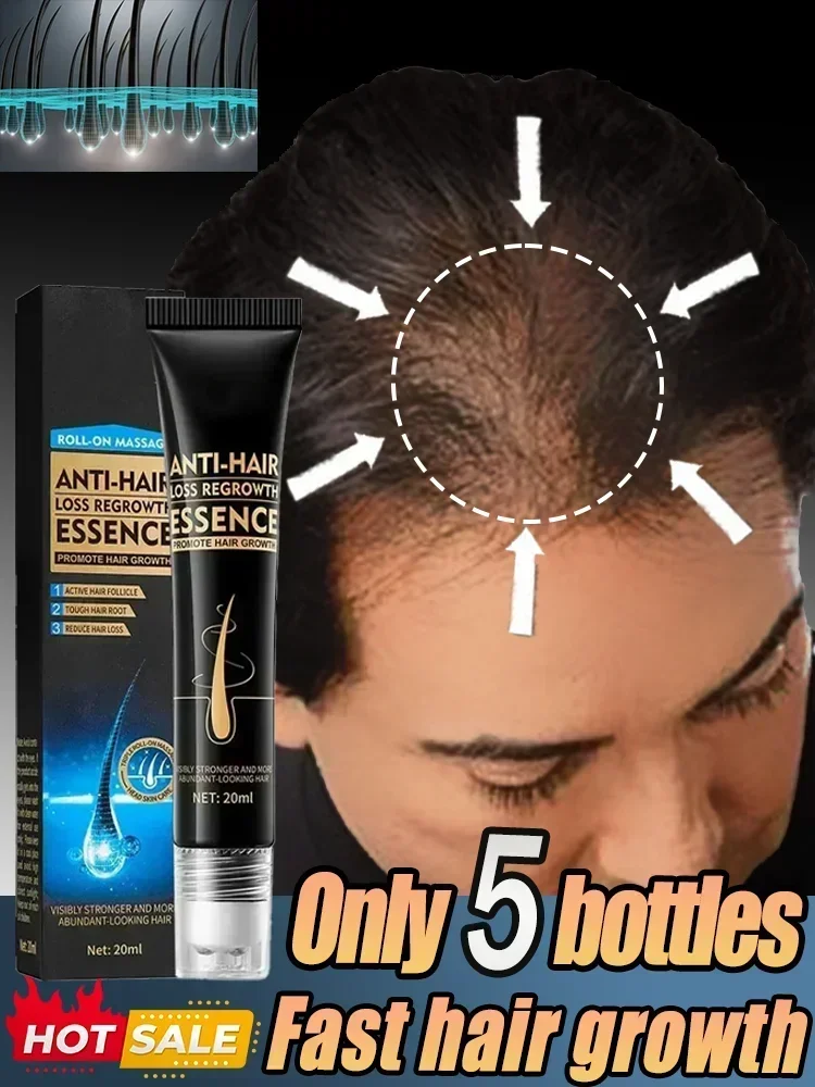 Sérum anti-chute de cheveux efficace, essence de croissance rapide des cheveux, réparation de la calvitie, post-partum héréditaire, séborrhéique, huile de soin