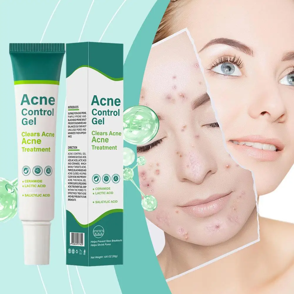 Salicylic Acid Gel Reduces Acne Marks, Shrinks Pores, Closes Ceramide Acne, Removes Acid Lactic Cream Acne Mouth, T1j4