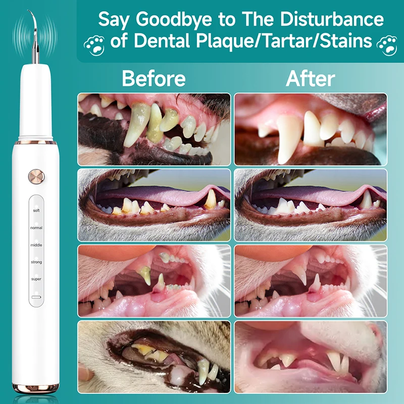 Thumbnail 3 - #29 Compare Ultrasonic Scalers Before You Buy
