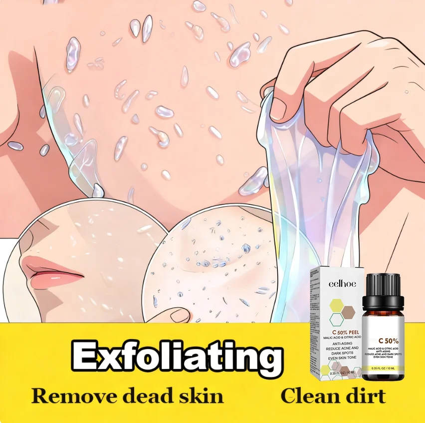 Chemisches Peeling-Serum. Entfernen Sie abgestorbene Haut. Glättet raue Haut. Textur minimiert Poren. Verpflanzt schuppige, trockene Pflaster