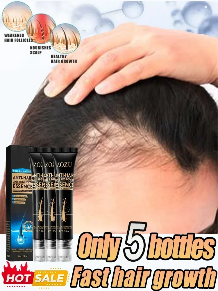 

Premium Hair growth treatment Effective Anti Hair Loss Serum Scalp treatment Hereditary Postpartum Seborrheic Hair Care