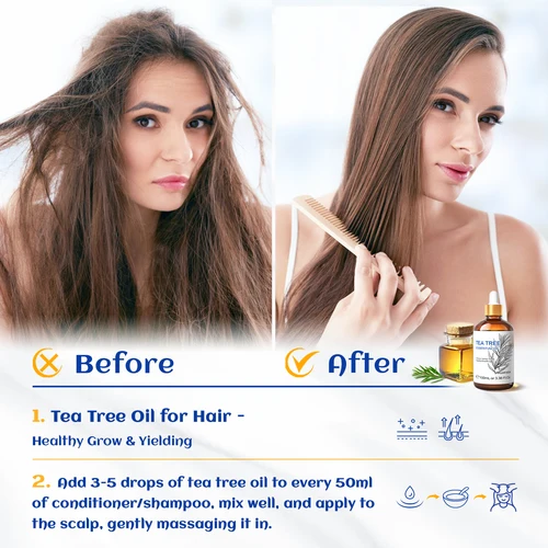 Imagen 2 del producto HIQILI 100% aceite esencial de árbol de té 100ml para masaje de aromaterapia DIY belleza piel relajación del cabello lavanda jengibre sándalo ​ ​