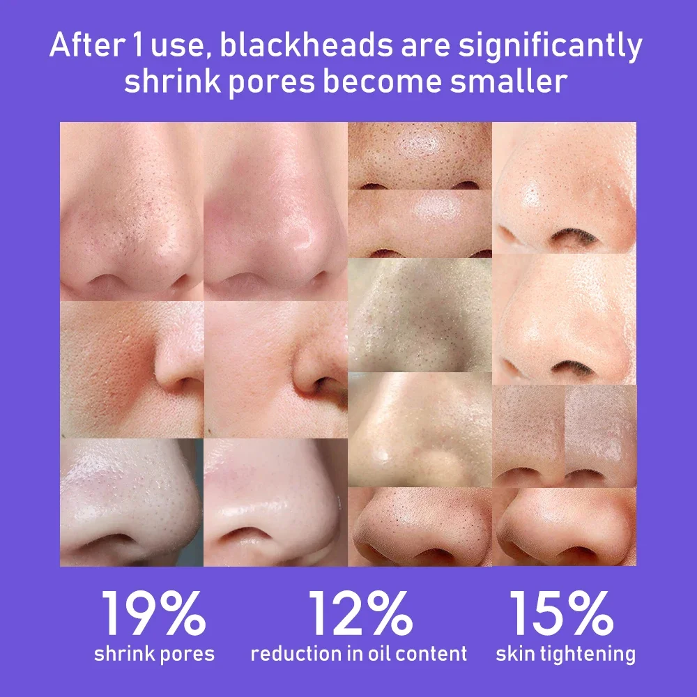 얼굴 블랙헤드 빠는 미용기, 3단 모드로 블랙헤드를 효과적으로 빨아들이는 홈 스킨 케어 도구