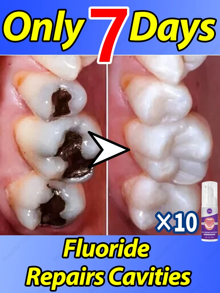 

Solve caries and tooth decay problem