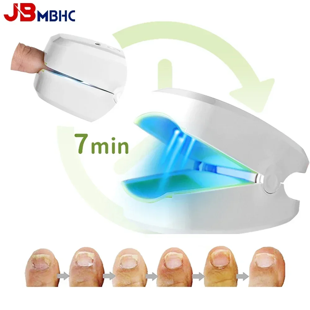 

Nail Fungus Laser Treatment Device USB Charging Fingernails Toenails Onychomycosis Therapy Cure Machine Unisex Foot Care Tools