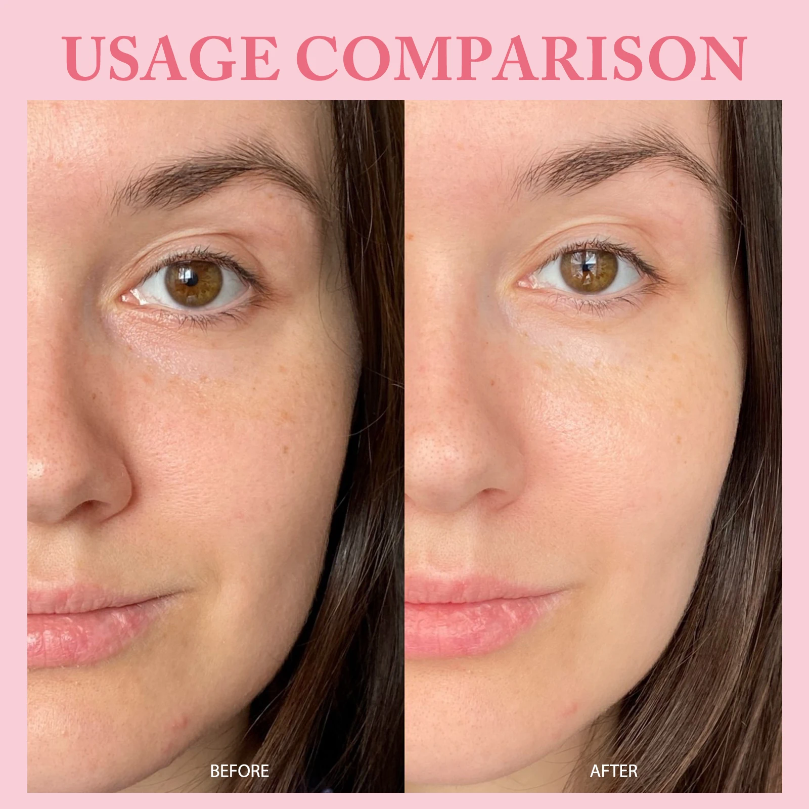 مجموعة كريم السلمون الوردي الثلاثي الألوان - مصل السهرة DIMOT المكون من 10 قطع لمعالجة البقع الداكنة والبشرة. مناسبة لجميع أنواع البشرة.