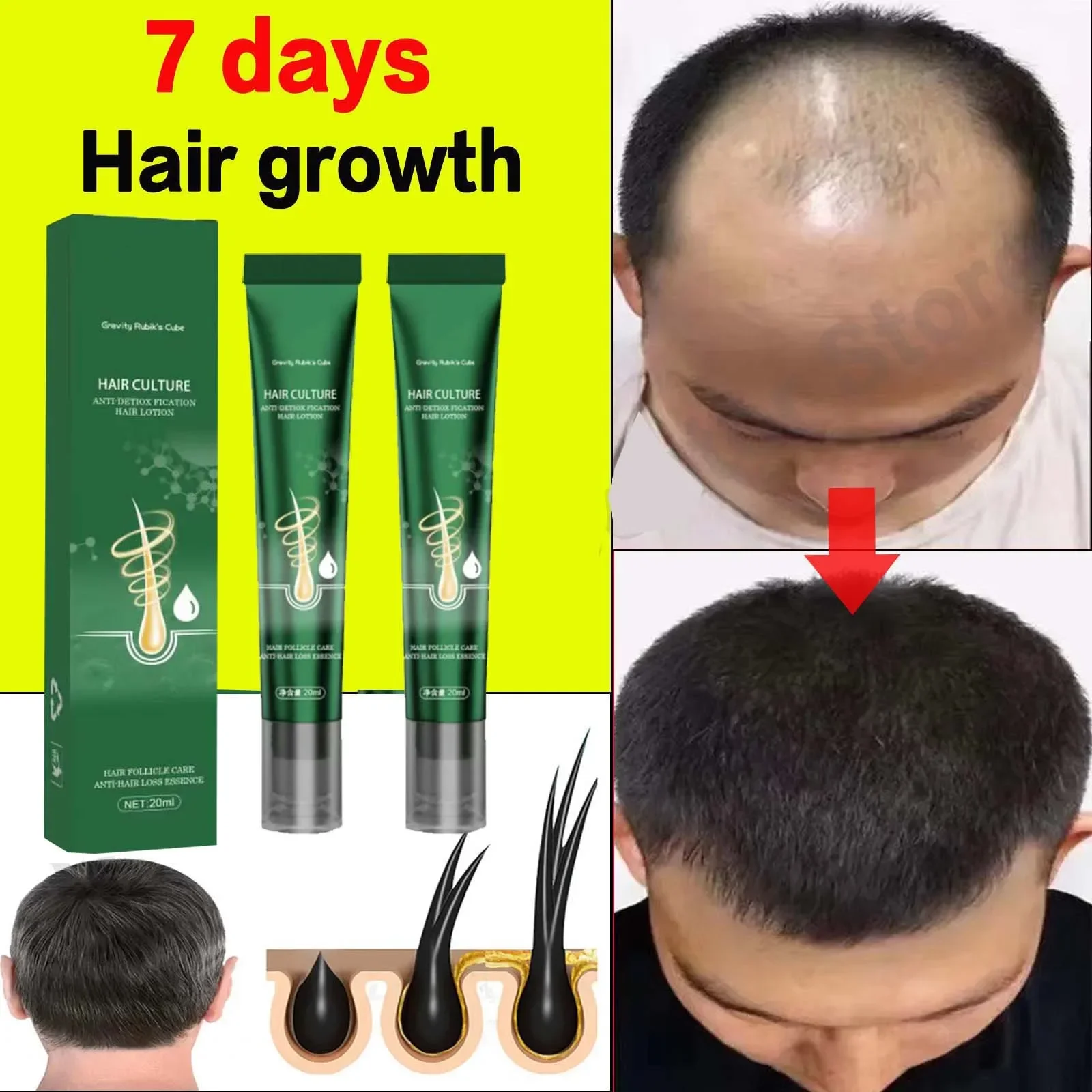 Hair Growth Oil Effective Repair Scalp Tissue Treatment and Prevention of Hair Loss Keratin Hair Treatment for Men and Women