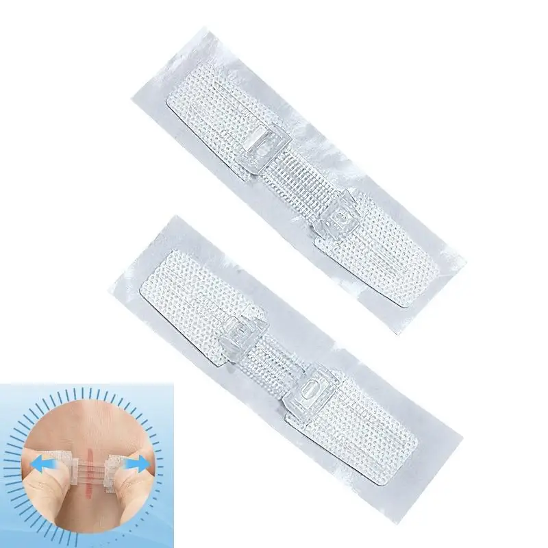 

1 шт., завязка на молнии, пластырь для закрытия ран, пластырь на молнии, быстрый шов, уличный портативный кровоостанавливающий пластырь, инструмент первой помощи