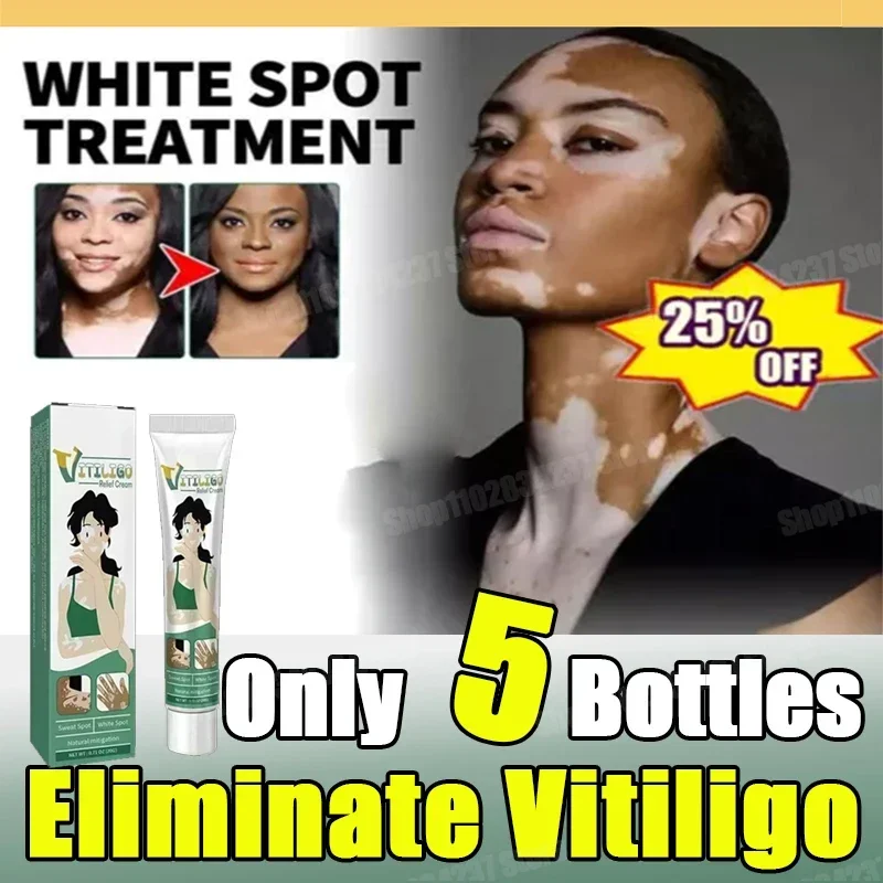 Newvitiligo magic tool