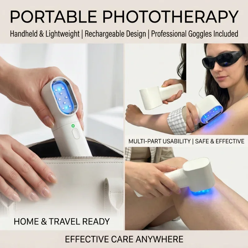 308nm LED UVB Excimer Laser Phototherapy Lamp Medical Device Skin Disease Treatment for Psoriasis & Vitiligo Therapy - view 6