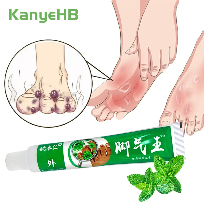 

1pcs Anti Fungal Infections Beriberi Cream For Athlete's Foot Tinea Pedis Relief Foot Itch Erosion Peeling Medical Plaster S053