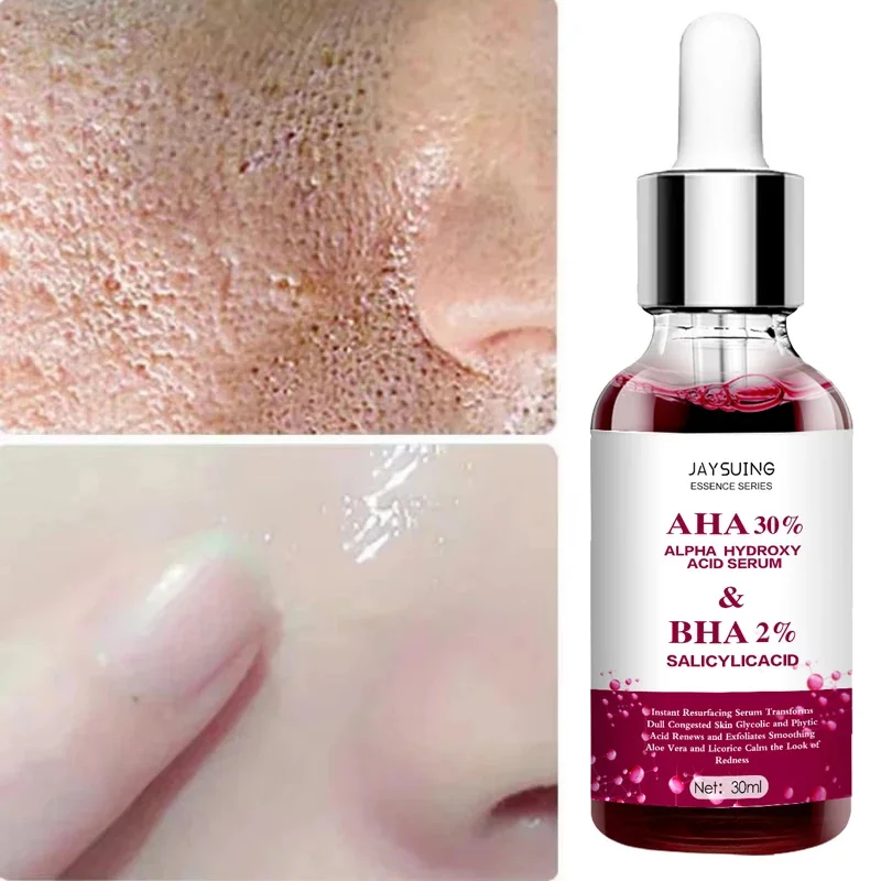 

Remove Large Pores Serum Lactic Acid Facial Pore Shrinking Repairing Products Pore Minimizing Firming Smooth Korean Skin Care