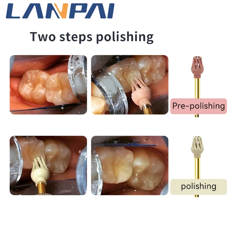 Lanpai-pulidor de diamante de goma Dental, helicoide para discos de pulido compuestos, herramientas de odontología, rueda de pulido de laboratorio,