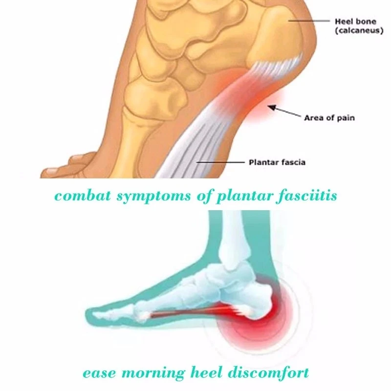 2-Paar Kompressionssocken zur Knöchelunterstützung, offenes Zehendesign zur Schmerzlinderung bei Plantarfasziitis – Detail 8