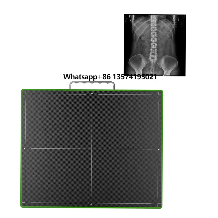 

Medical X-ray Equipments & Accessories Wireless and Wired Flat Panel Detector Digital Radiography DR 14*17"