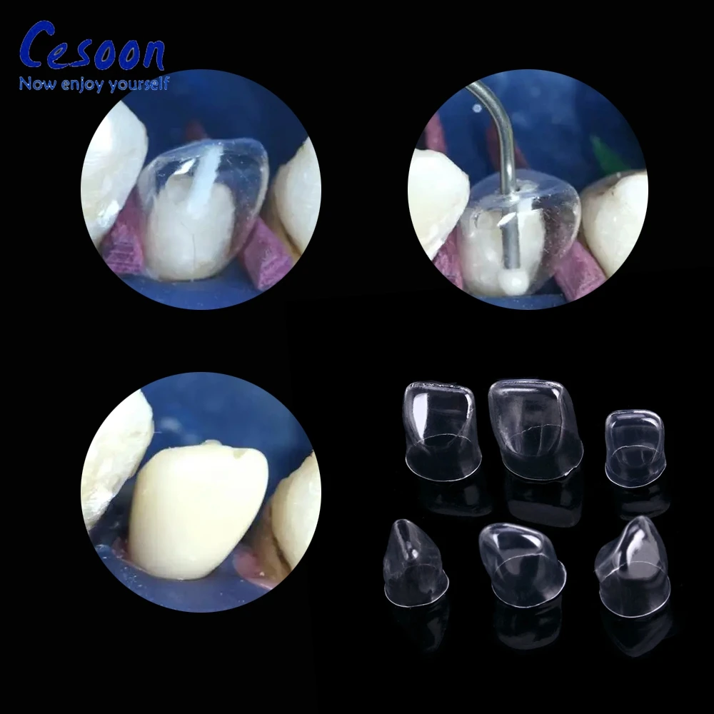 64Pcs Dental Transparent Crowns Anterior Posterior Deciduous Temporary Preformed Molar Tooth Crown Adult Kids Dentistry Material