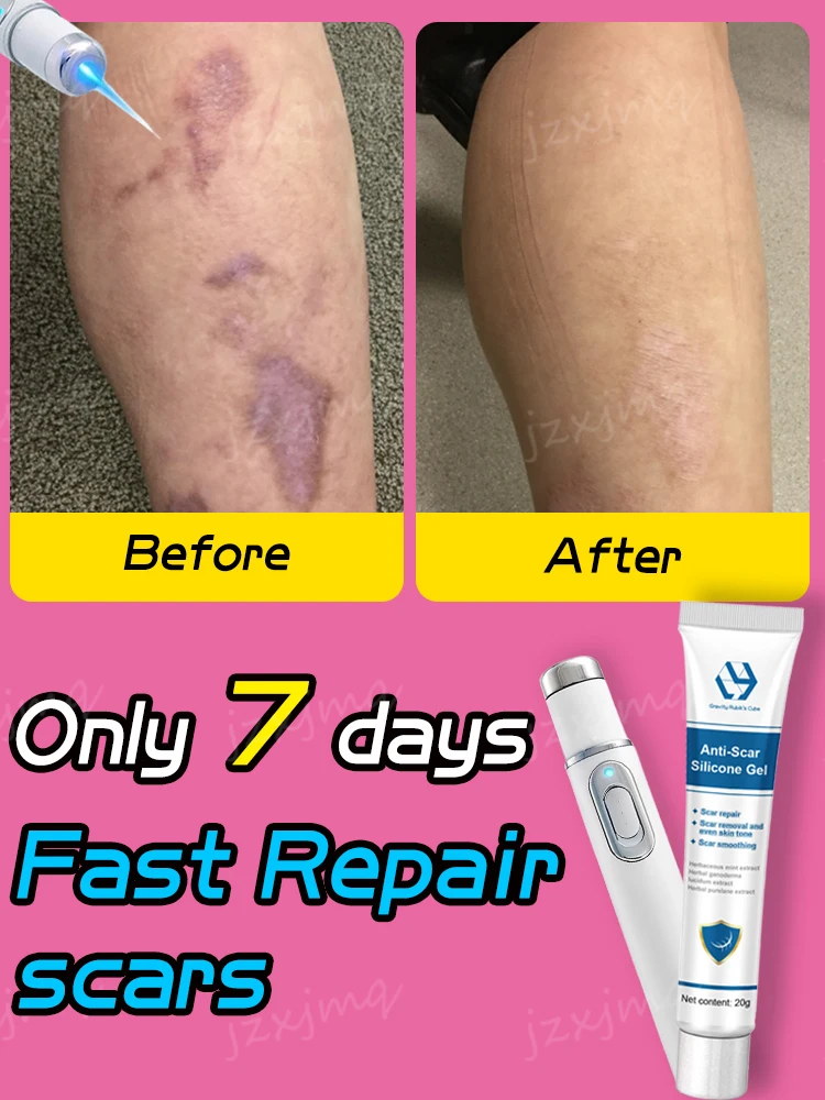 Blue Light Laser Repair Scars Hot Selling