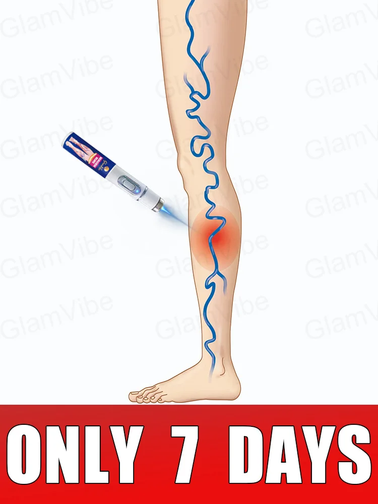 

blue light pen solve varicose veins, hot sale leg care tools