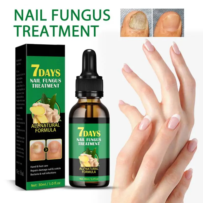 

1PCS Nail Laser Device Fingernail Fungus Treat Onychomycosis Therapy Effectively Remove Onychomycosis Grow Toe Nail