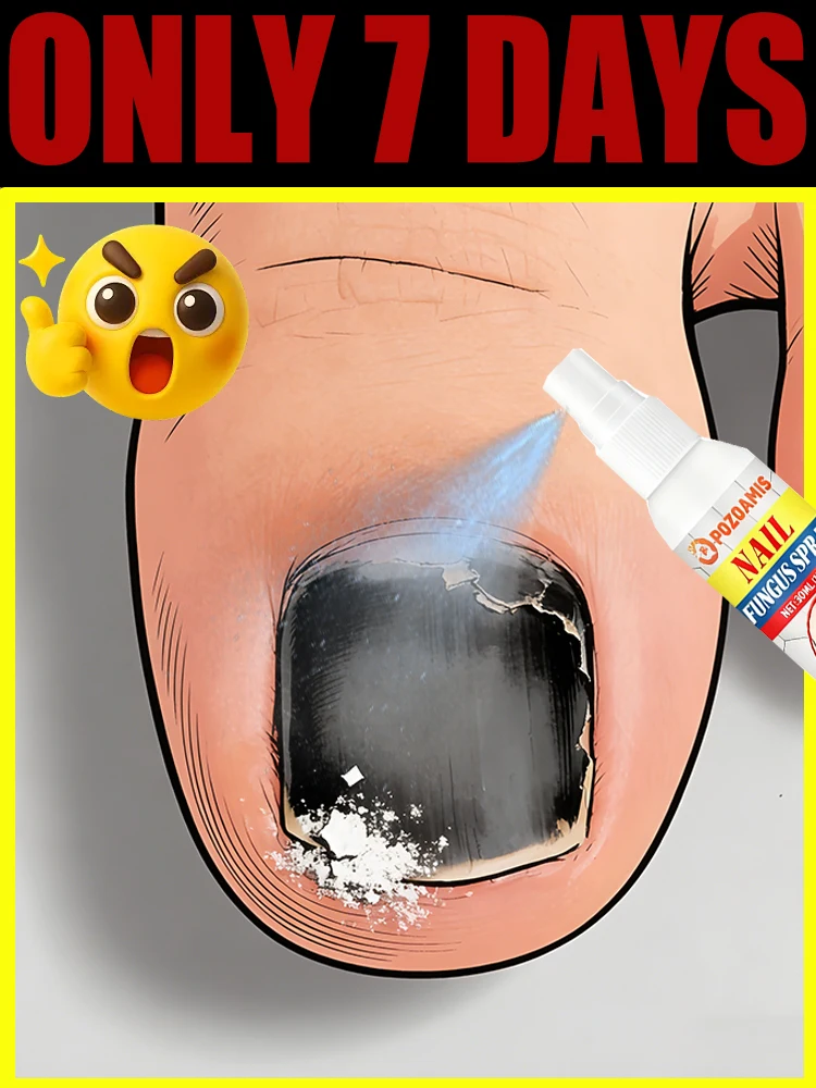 

Get rid of toenail fungus in 7 days and have brand new nails ᵃⁿᵈ ˢᵃʸ ᵍᵒᵒᵈᵇʸᵉ ᵗᵒ ʳᵉᶜᵘʳʳⁱⁿᵍ