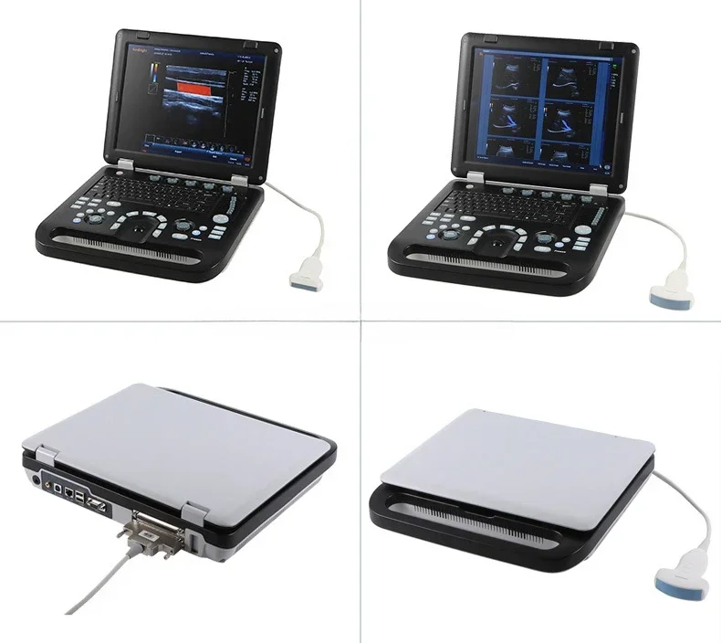 portable ultrasound used laptop 3D hospital color Doppler machine