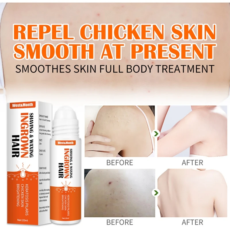 20ml Ingrown Hair Cream Bump Removal Stopper Treatment Waxing Skin Redness Repairing Shaving Reduce Serum After Prevent