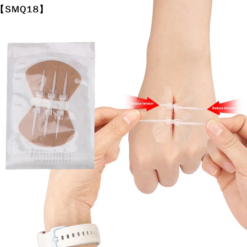 Zipper Band-aid Painless Wound Closure Device Suture-free Wound Dressing Patches Zip Suture Reducer Band Aid【SMQ】