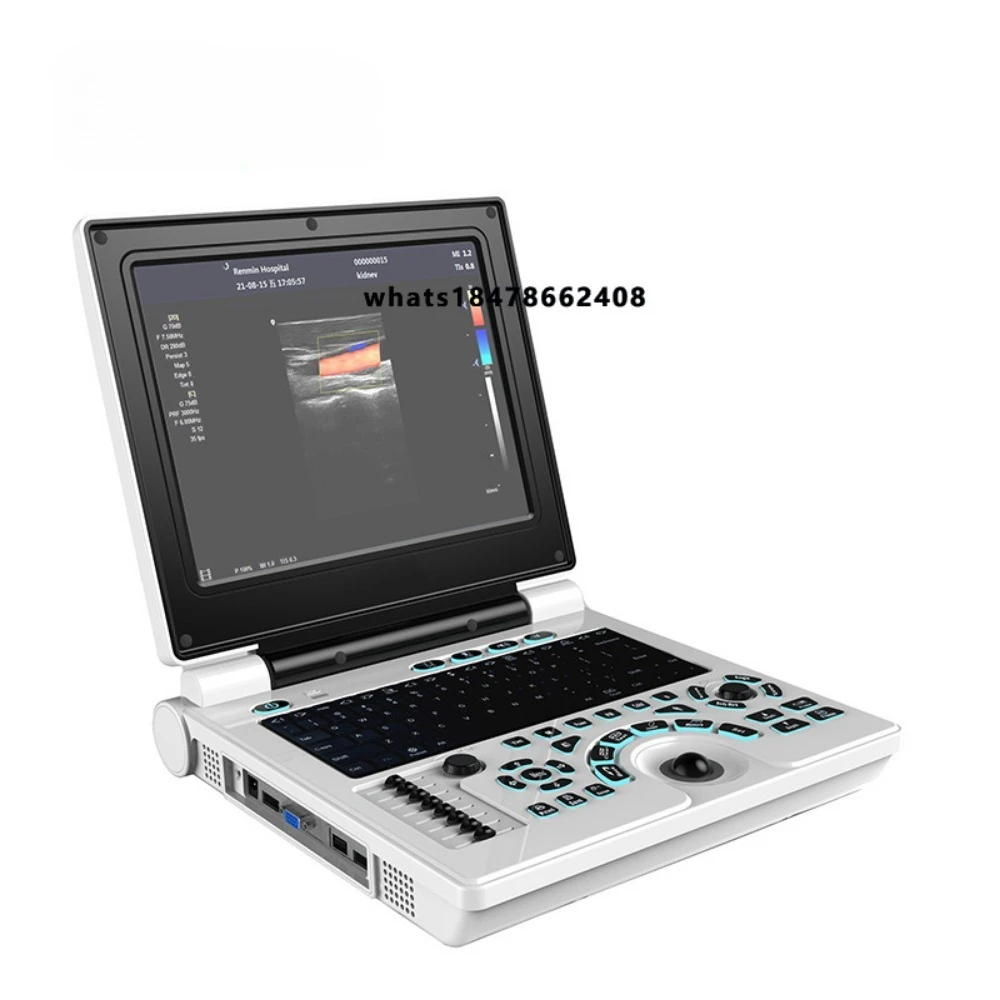 Direct supply of VET portable veterinary ultrasound equipment