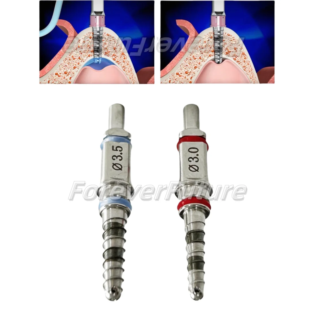 Dental Water Rising Hydraulic Membrane Lifter Drill Hiossen Sinus Lift Drills 3.0/3.5