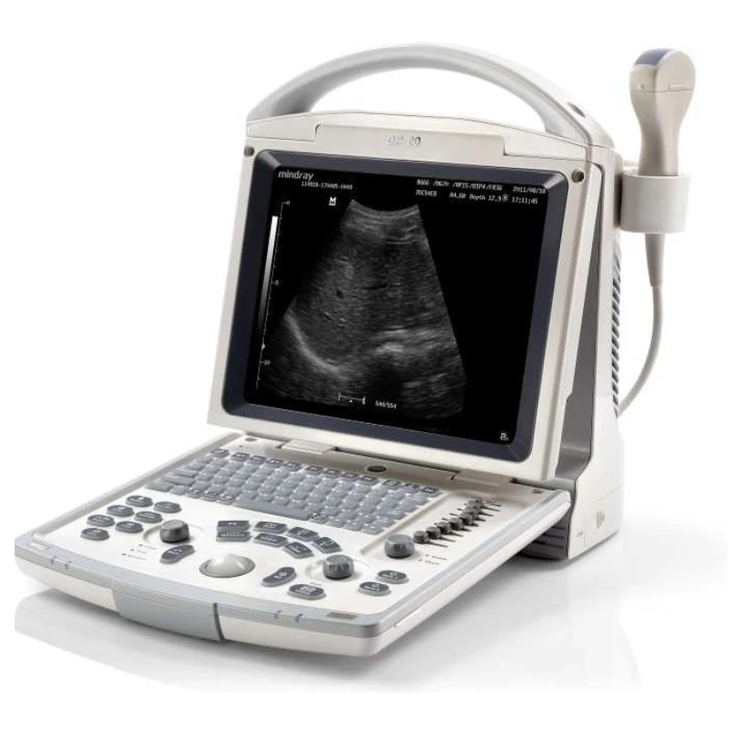 Used Mindray Digital  Diagnostic Imaging System DP-20 Ultrasound Machine for Human