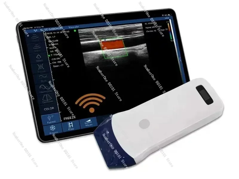 Linear Probe 3D 4D Color Doppler Ultrasonido Machine Wireless Wifi Portable Ultrasound Scanner