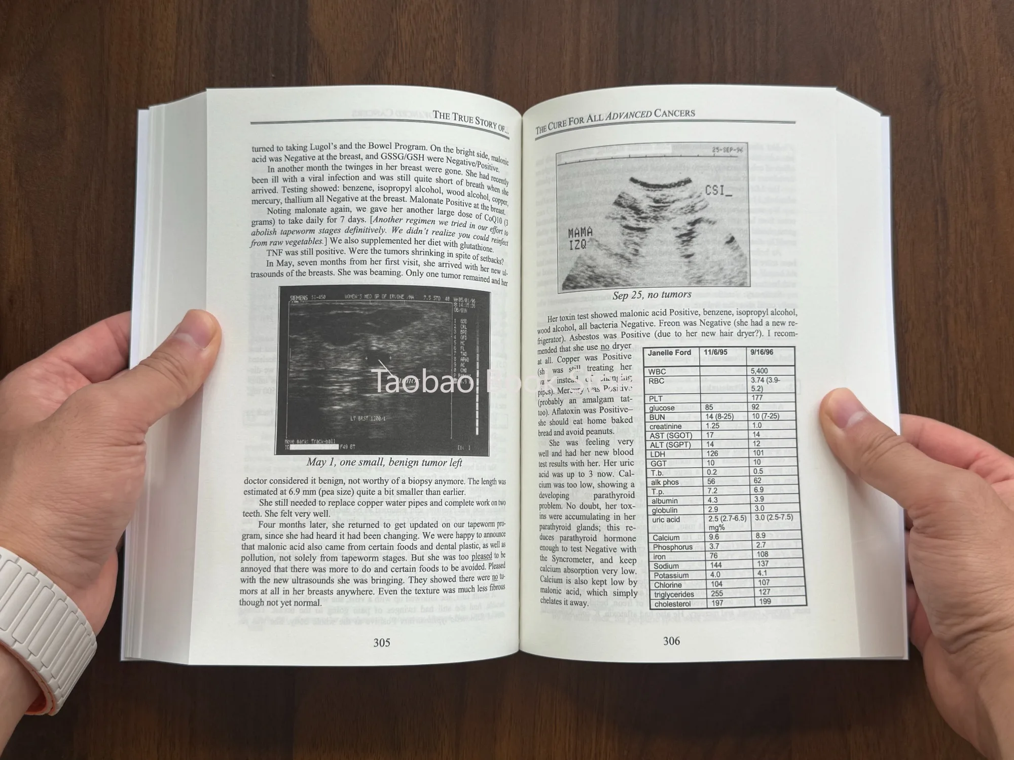 The Cure for All Advanced Cancers Book By Dr. Hulda Clark | Tumor Treatment Natural Therapy Guide  Libros