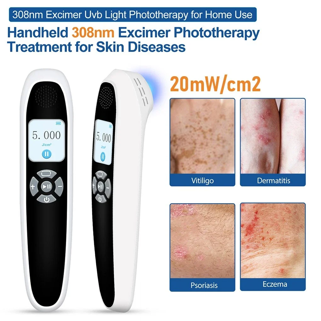 

Frovab Portable 308nm Excimer UVB Light Therapy Device 6 Diodes Targeted Small Area Treatment of Vitiligo & Psoriasis 20mW/cm²