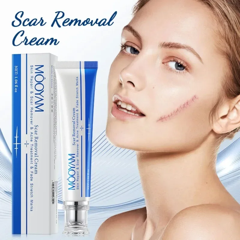 Scar repairing removing Cross border Scar repairing removing face cream Repairing Stretch Marks Whitening Pigmentation