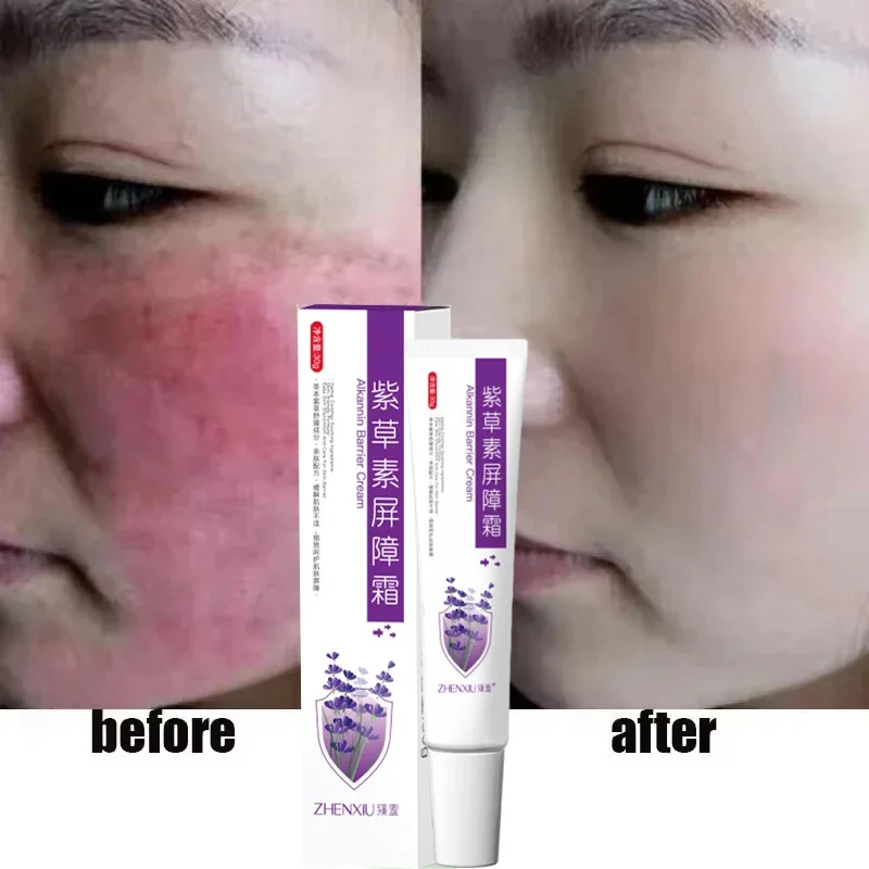 Repair Facial Redness Cream Instant Spider Vein Remove Sensitive Skin Sooth Anti Redness Rosacea Treat Lotion Korean Cosmetics