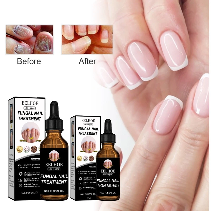 Nail Repair Solution Thickening Bright Nails Remove Onychomycosis Dead Skin Toe Nails Fungus Treatment Moisturizing foot Essence