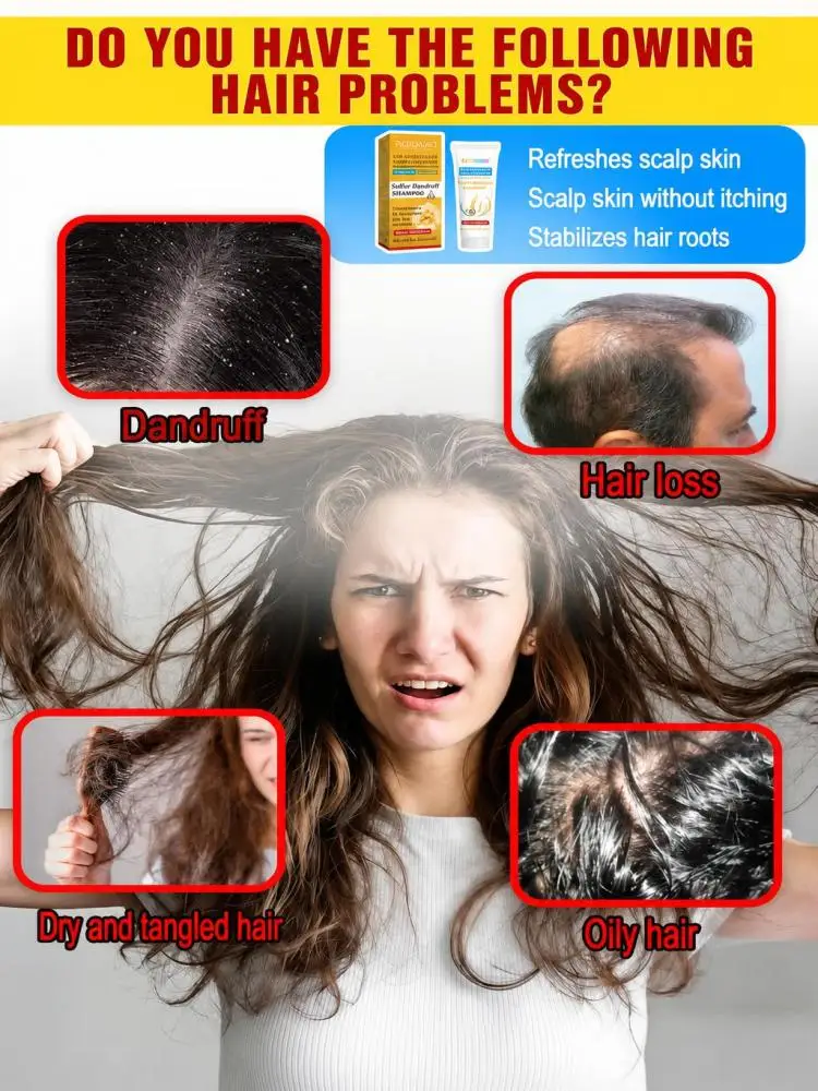 Daily‑Use Sulfur Hair Shampoo, Deep Mild Scalp Cleansing, Lessen Noticeable Dandruff, Ease Discomfort Of Scalp, Reinforce Fragile Hair Roots, Reduce Broken Hair & Hair‑Shedding Appearance for Unisex At‑Home Hair Washing Routine