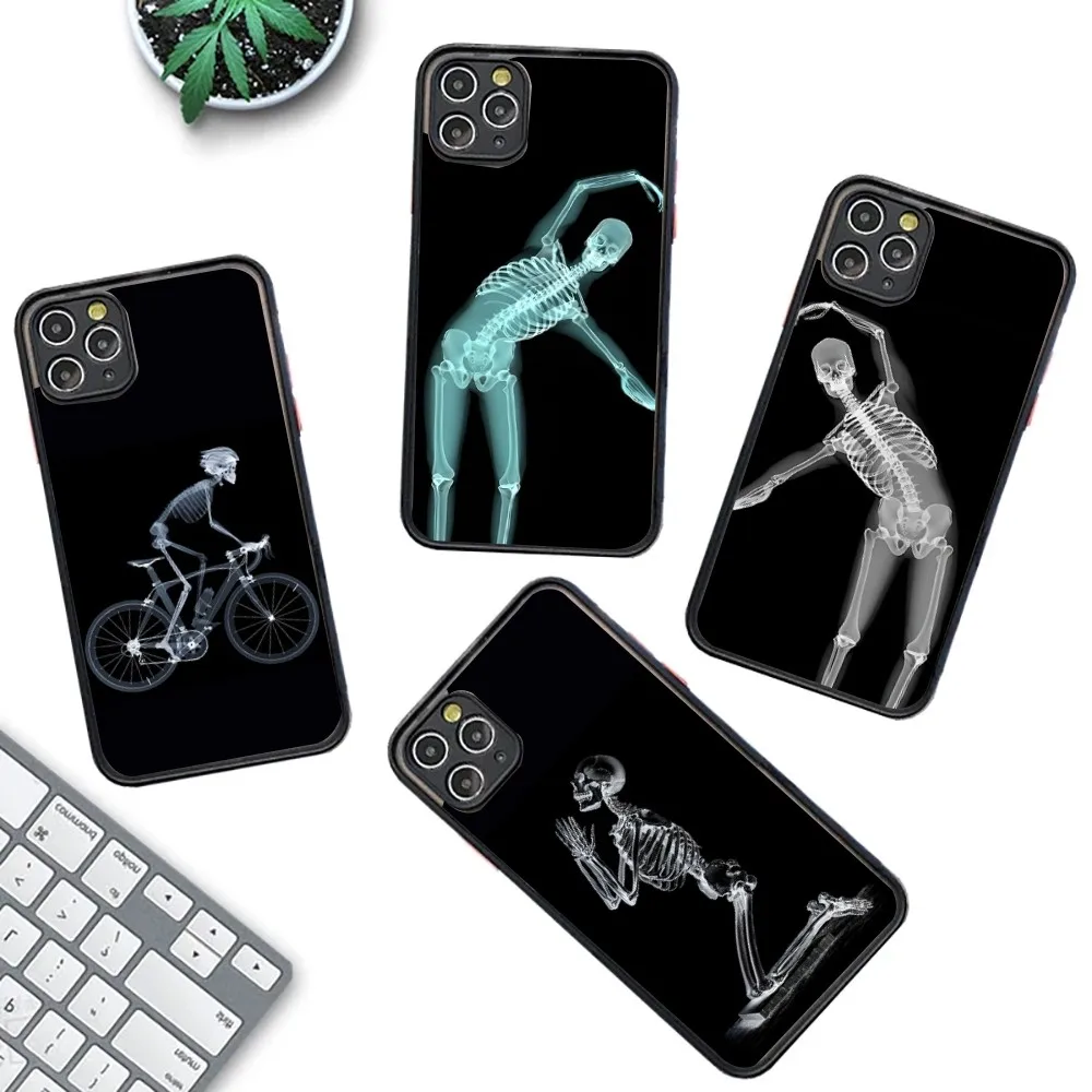 

Radiological Human Organs Skeleton Phone Case For IPhone 14 11 12 13 Mini Pro Max 8 7 Plus X XR XS MAX Translucent Matte Cover