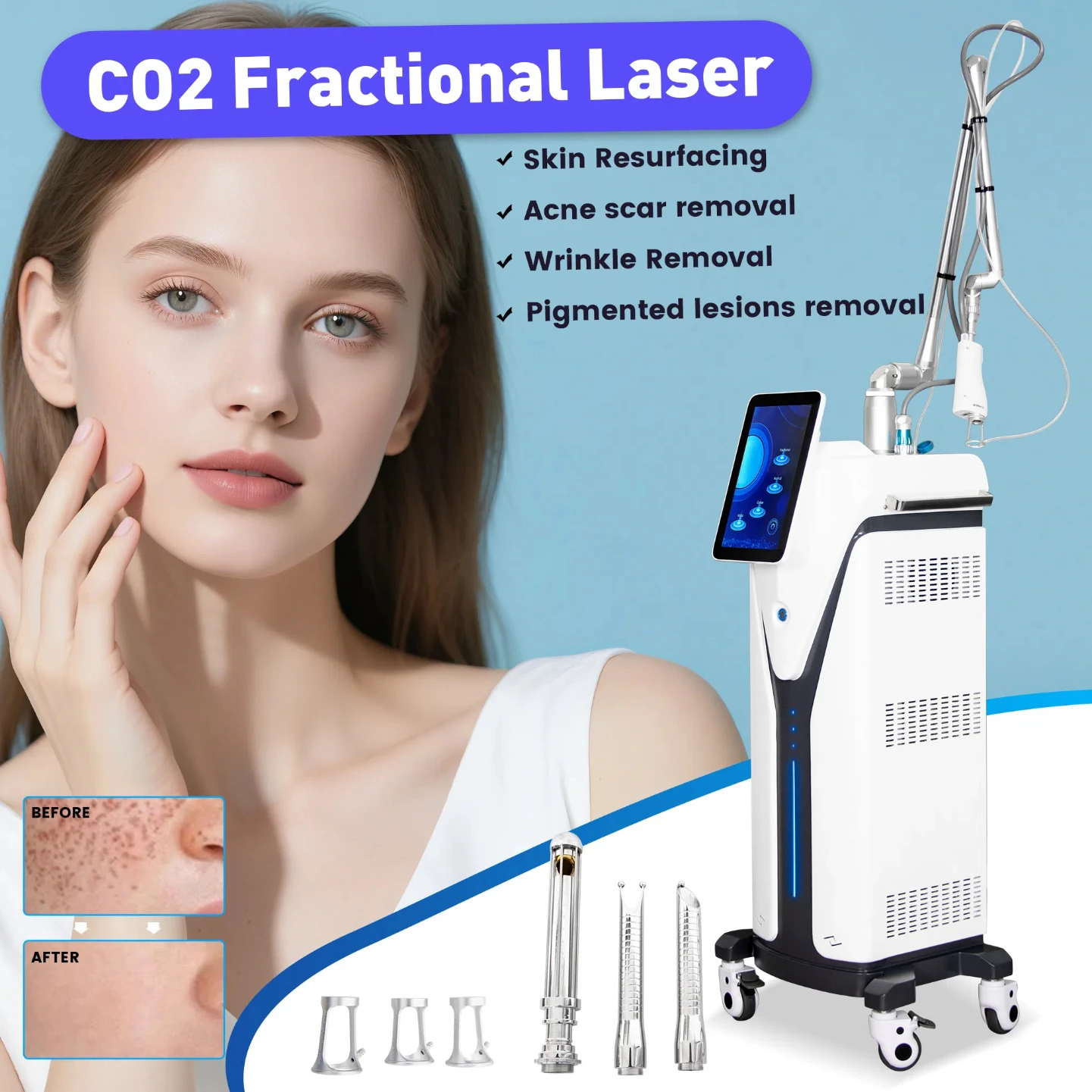 Appareil de beauté au laser CO2 fractionné 10600 nm